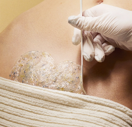 Épilation Maillot Intégral + Soin Vajacial Anti-tâches